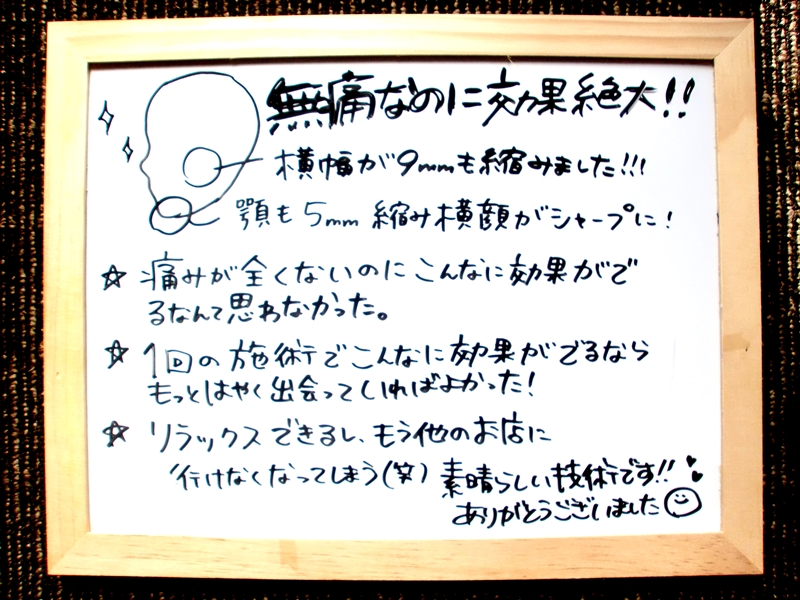 小顔矯正の感想