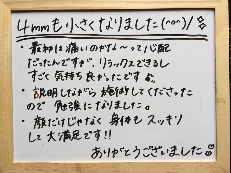 小顔矯正の感想