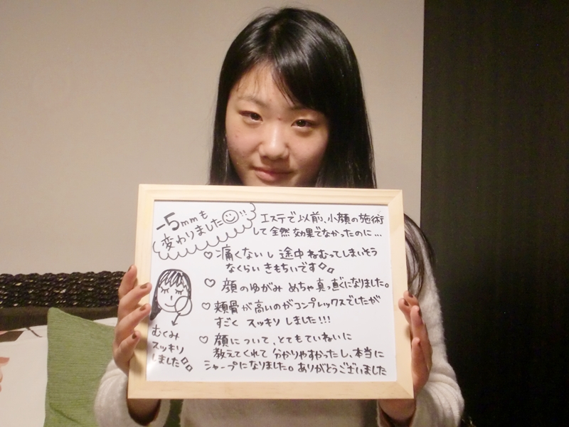 小顔矯正の感想